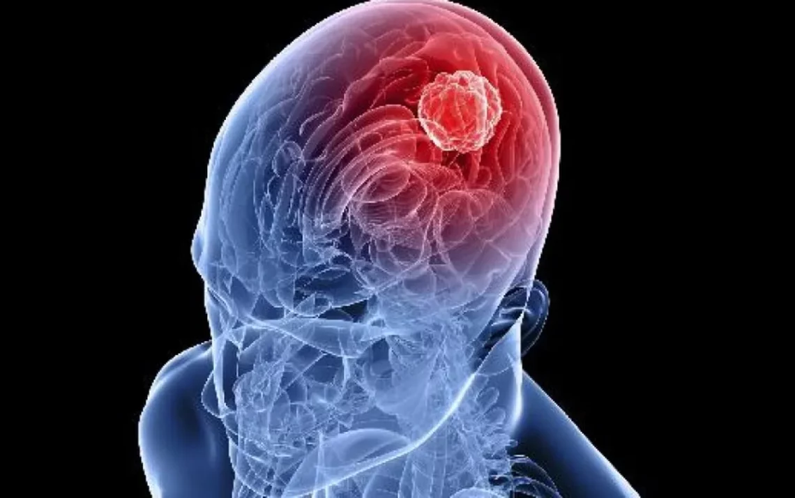 vacina contra glioblastoma;