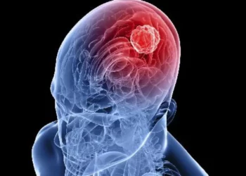 vacina contra glioblastoma;