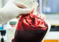 transfusão, transfusão de sangue;